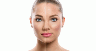 تفتيح البشرة