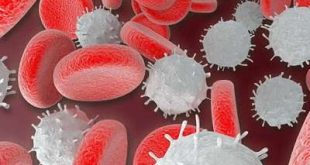 علاج نقص كرات الدم البيضاء