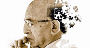 مرض الزهايمر