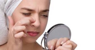 طرق طبيعية لإزالة الرؤوس السوداء