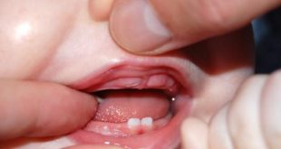 علامات التسنين عند الأطفال